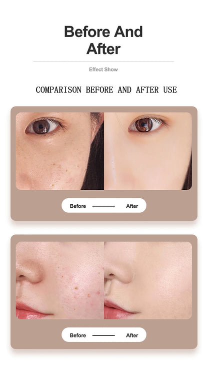 Digital Fibroblast Plasma Beauty Pen